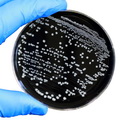 UK: Foodborne campylobacter outbreaks at catering premises and catered events