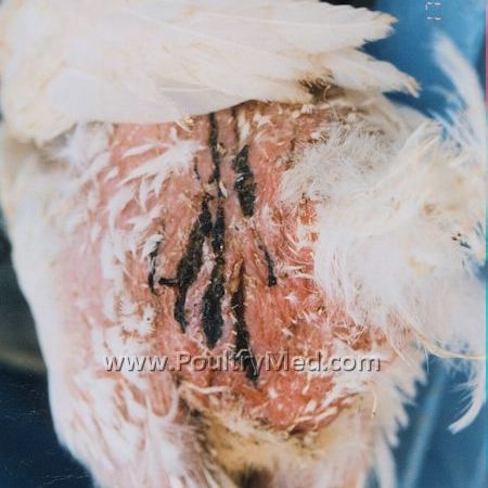 WHO to help fund influenza vaccine plants in developing world