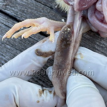 Human Influenza vaccination