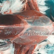 Metabolic & Miscellaneous Disorders