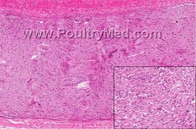 Riboflavin deficiency