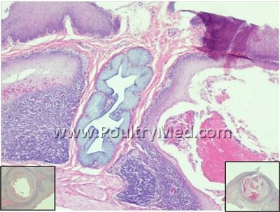 Vitamin A Deficiency