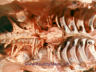 Riemerella anatipestifer