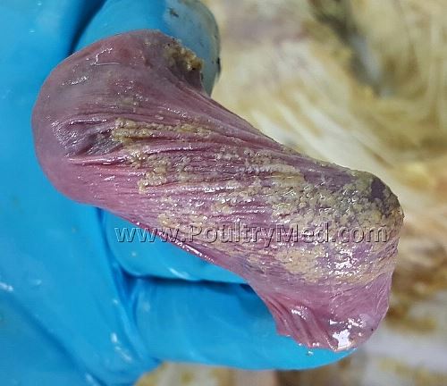 Trush - Candida albicans