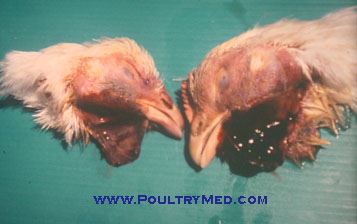 Sulphonamide poisoning