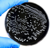 CDC: Campylobacter Infection in Poultry-Processing Workers, Virginia, USA, 2008–2011